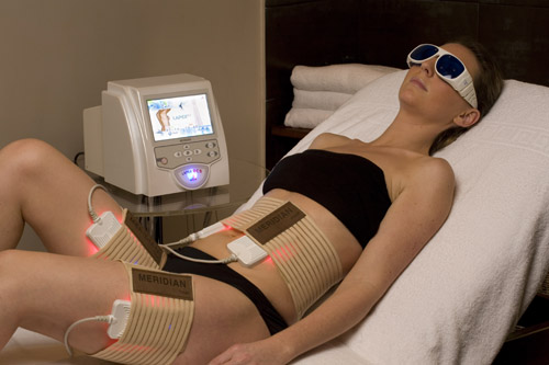 Low Level Laser Therapy (LLLT), Lapex, lipolyse, cellulite